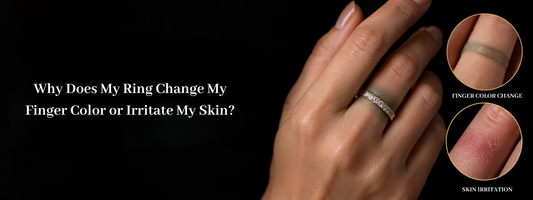Why Does My Ring Change My Finger Color or Irritate My Skin?